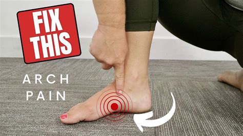 Arches Hurt when Running: An Analysis of Foot Pain during Exercise and Its Remedies